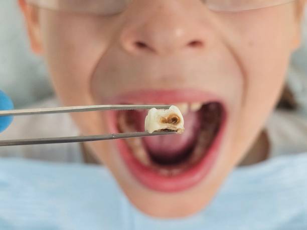 Best Pediatric Emergency Dentist in Taos, MO